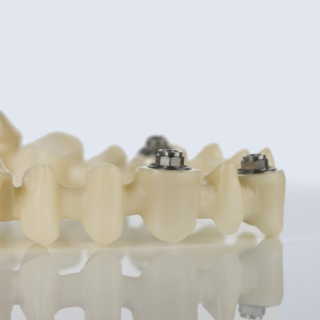 AG_Showcase_Ceramill_ZI_01