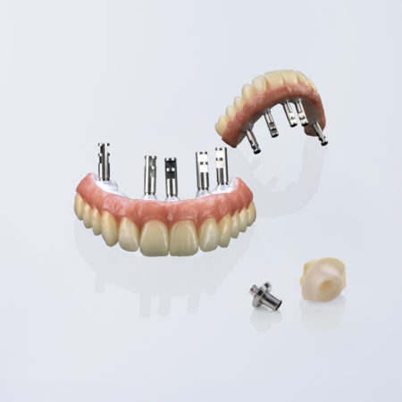 AG_Showcase_Ceramill_Zi_by_Ulrich_Werder