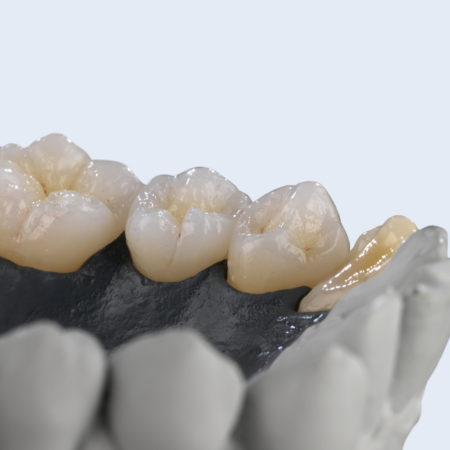 AG_Showcase_Ceramill_Zolid_FX_01