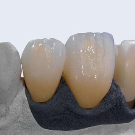 AG_Showcase_Ceramill_Zolid_FX_02